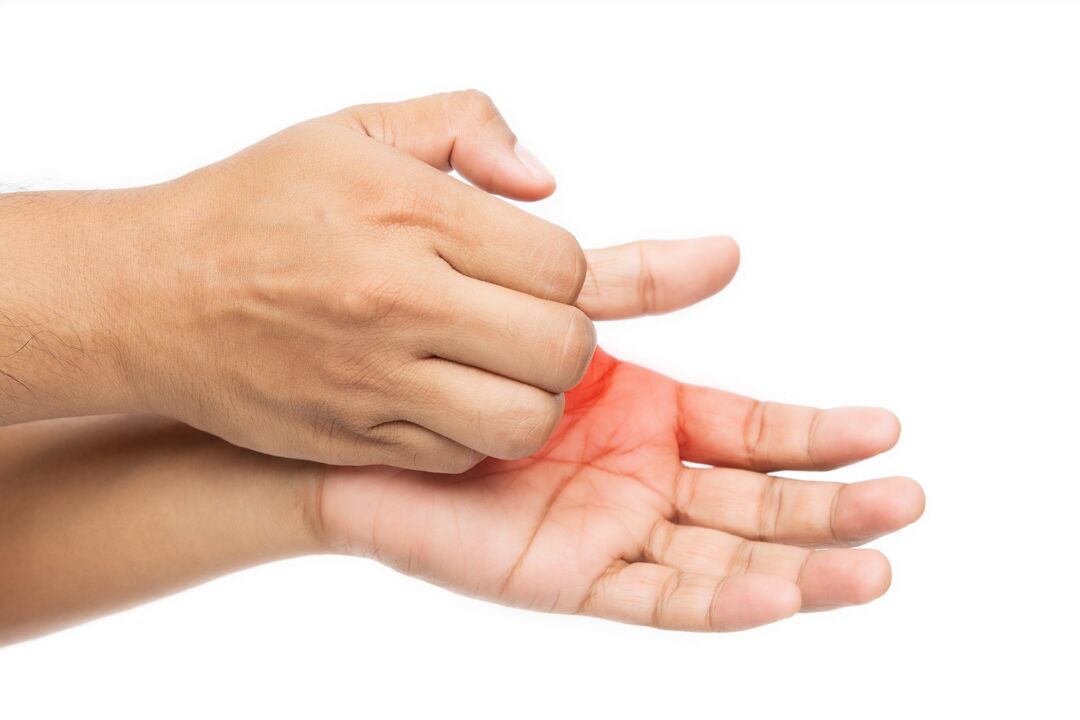 Itching with fungi and its treatment with demyxil cream