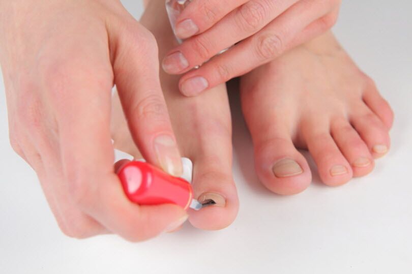 Prevention of feet mushrooms